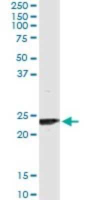 Immunoprecipitation: UBE2T Antibody (4G1-4C2) [H00029089-M02]