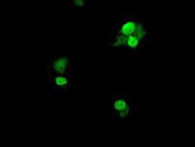 Immunocytochemistry/ Immunofluorescence: UBE2T Antibody (OTI2F5) - Azide and BSA Free [NBP2-74750]