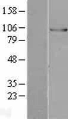 Western Blot: E6AP/UBE3A Overexpression Lysate [NBL1-17551]