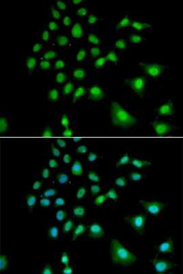 Immunocytochemistry/ Immunofluorescence: UBE3C Antibody - BSA Free [NBP2-94023]
