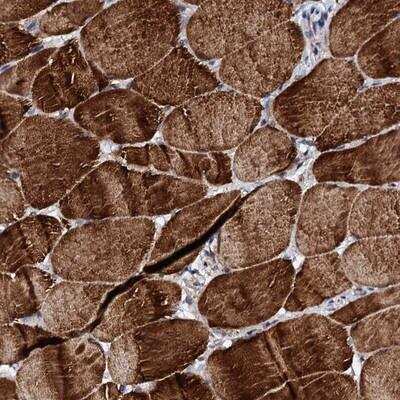 Immunohistochemistry-Paraffin: UBE3C Antibody [NBP1-81558]