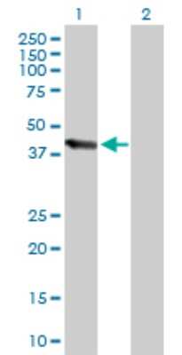 Western Blot: UBE3C Antibody [H00009690-B01P]