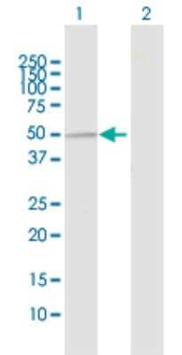 Western Blot: UBE3C Antibody [H00009690-D01P]