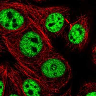 Immunocytochemistry/ Immunofluorescence: UBE4A Antibody [NBP2-56653]