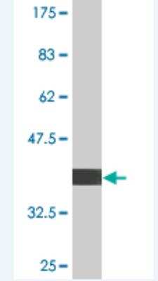 Western Blot: UBE4B Antibody (1D5) [H00010277-M02]