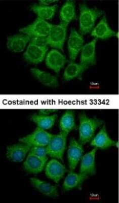 Immunocytochemistry/ Immunofluorescence: UBE4B Antibody [NBP1-32737]