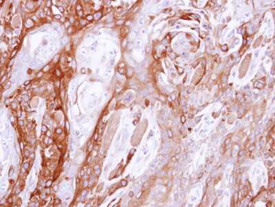 Immunohistochemistry-Paraffin: UBE4B Antibody [NBP1-32737]