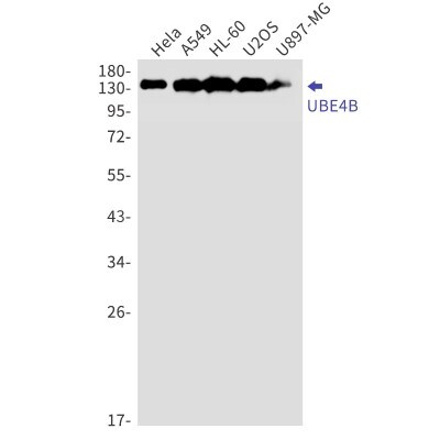 Western Blot: UBE4B Antibody (S04-6C6) [NBP3-19924]