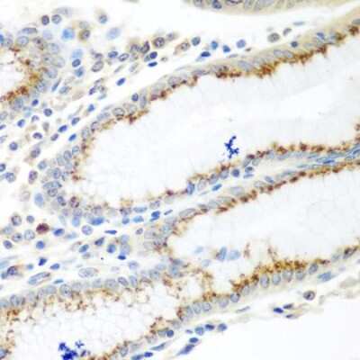 Immunohistochemistry-Paraffin: UBIAD1 Antibody - BSA Free [NBP2-93402]