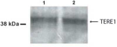 Western Blot: UBIAD1 AntibodyBSA Free [NB100-468]