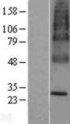 Western Blot: UBIAD1 Overexpression Lysate [NBP2-07426]