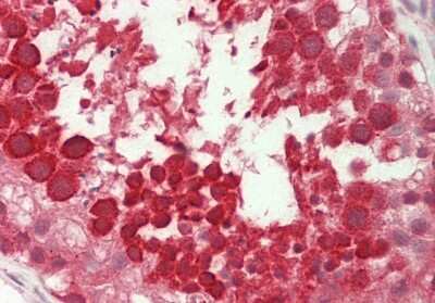 Immunohistochemistry-Paraffin: UBL5 Antibody [NBP2-86885]