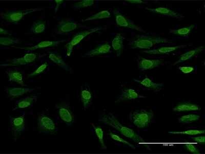 Immunocytochemistry/ Immunofluorescence: UBL7 Antibody [H00084993-B01P]
