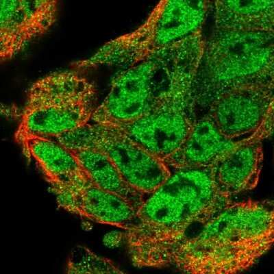 Immunocytochemistry/ Immunofluorescence: UBL7 Antibody [NBP2-58983]