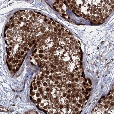 Immunohistochemistry-Paraffin: UBLCP1 Antibody [NBP1-85468]