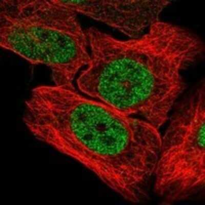 Immunocytochemistry/ Immunofluorescence: UBN1 Antibody [NBP3-17956]