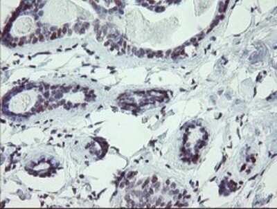Immunohistochemistry: UBOX5 Antibody (OTI8D5) [NBP2-46287]
