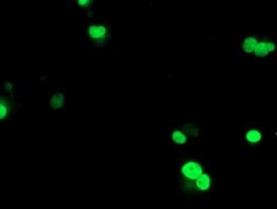 Immunocytochemistry/ Immunofluorescence: UBOX5 Antibody (OTI1C5) - Azide and BSA Free [NBP2-74760]