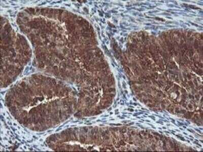 Immunohistochemistry: UBOX5 Antibody (OTI1C5) - Azide and BSA Free [NBP2-74760]