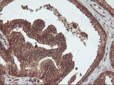 Immunohistochemistry-Paraffin: UBOX5 Antibody (OTI1C5) [NBP2-01077]