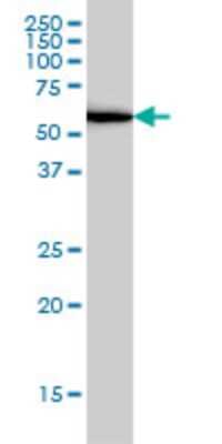Western Blot: UBP1 Antibody (1C5) [H00007342-M01]