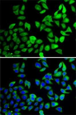 Immunocytochemistry/ Immunofluorescence: UBPY/USP8 Antibody - Azide and BSA Free [NBP2-94523]