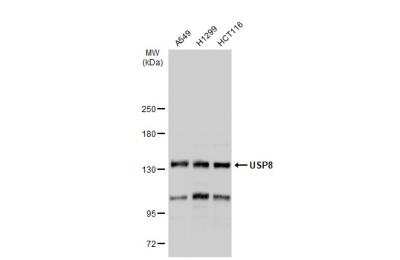Western Blot: UBPY/USP8 Antibody [NBP2-20792]