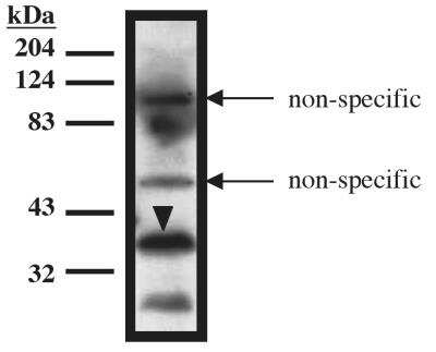 Western Blot: TUP1 Antibody (10) [NBP2-66596]