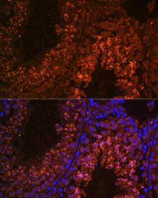 Immunohistochemistry: UBQLN3 Antibody - Azide and BSA Free [NBP2-93521]