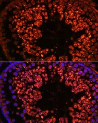 Immunohistochemistry: UBQLN3 Antibody - Azide and BSA Free [NBP2-93521]