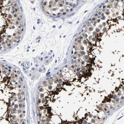 Immunohistochemistry-Paraffin: UBQLN3 Antibody [NBP1-86896]