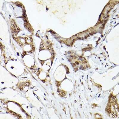 Immunohistochemistry-Paraffin: UBQLN4/CIP75 Antibody - Azide and BSA Free [NBP2-94330]