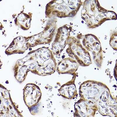 Immunohistochemistry-Paraffin: UBQLN4/CIP75 Antibody - Azide and BSA Free [NBP2-94330]