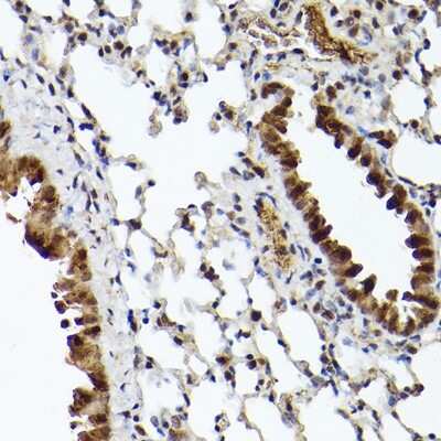Immunohistochemistry-Paraffin: UBQLN4/CIP75 Antibody - Azide and BSA Free [NBP2-94330]