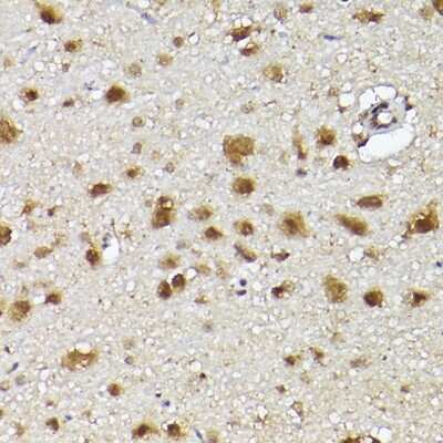 Immunohistochemistry-Paraffin: UBQLN4/CIP75 Antibody - Azide and BSA Free [NBP2-94330]