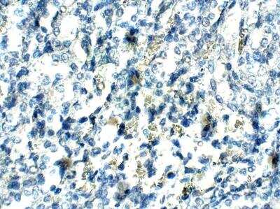 Immunohistochemistry-Paraffin: UBR1 Antibody [NBP3-12361]
