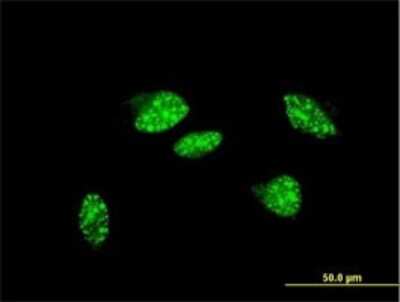 Immunocytochemistry/ Immunofluorescence: UBR2 Antibody (4G4) [H00023304-M01]