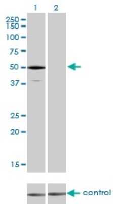 Western Blot: UBR2 Antibody (4G4) [H00023304-M01]