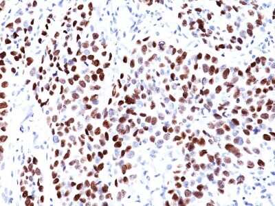 Immunohistochemistry-Paraffin: UBR2 Antibody (PCRP-UBR2-1D12) [NBP3-13900]