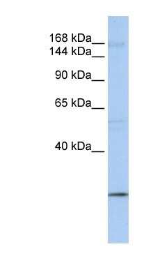 Western Blot: UBR2 Antibody [NBP1-54982]