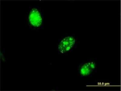 Immunocytochemistry/ Immunofluorescence: UBR4 Antibody (2D12) [H00023352-M01]