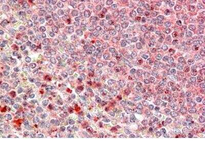 Immunohistochemistry-Paraffin: UBR4 Antibody [NBP1-45235]