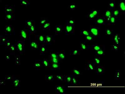 Immunocytochemistry/ Immunofluorescence: UBTF Antibody (2D8) [H00007343-M04]