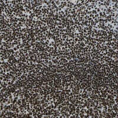 Immunohistochemistry-Paraffin: UBTF Antibody [NBP1-82545]