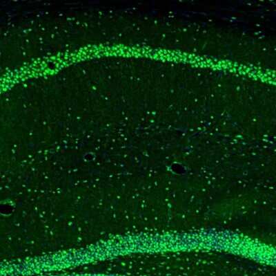 Immunohistochemistry: UBTF Antibody [NBP1-82545]