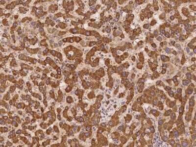 Immunohistochemistry: UBXD2 Antibody [NBP3-05991]