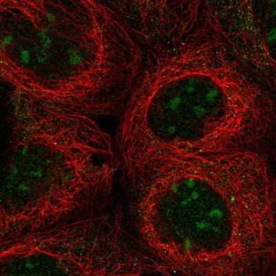 Immunocytochemistry/ Immunofluorescence: UBXD5 Antibody [NBP2-58719]