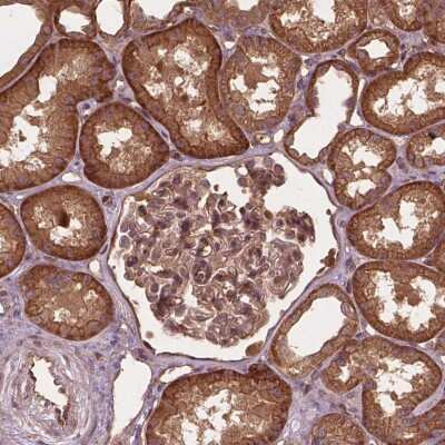 Immunohistochemistry-Paraffin: UBXN2A Antibody [NBP2-49448]