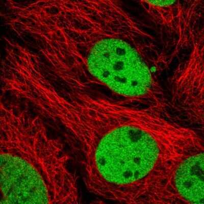 Immunocytochemistry/ Immunofluorescence: UBXN7 Antibody [NBP2-47589]