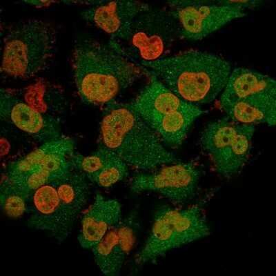 Immunocytochemistry/ Immunofluorescence: UCH-L1/PGP9.5 Antibody (13C4) - Azide and BSA Free [NBP2-33186]